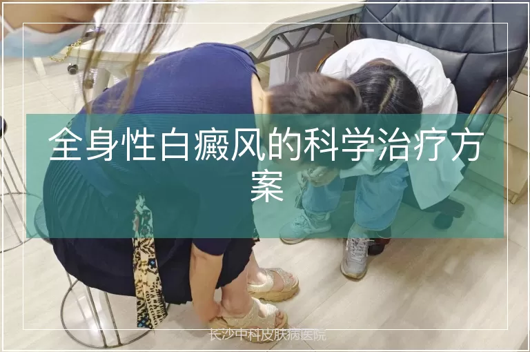 全身性白癜风的科学治疗方案