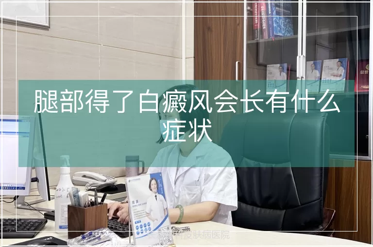 腿部得了白癜风会长有什么症状