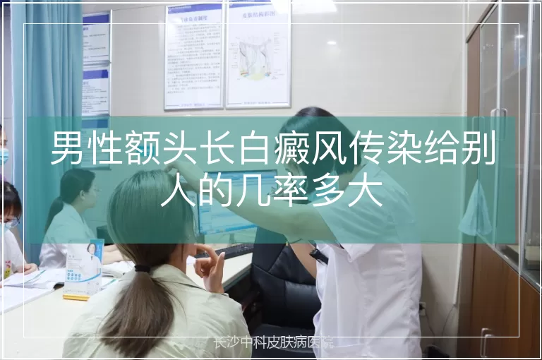 男性额头长白癜风传染给别人的几率多大