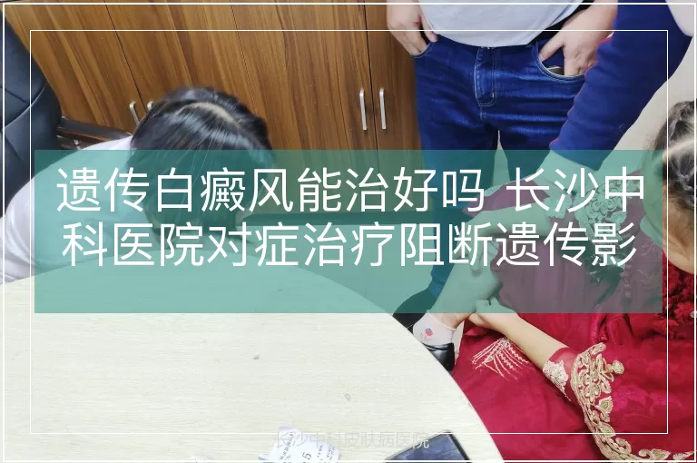 遗传白癜风能治好吗 长沙中科医院对症治疗阻断遗传影响全解析