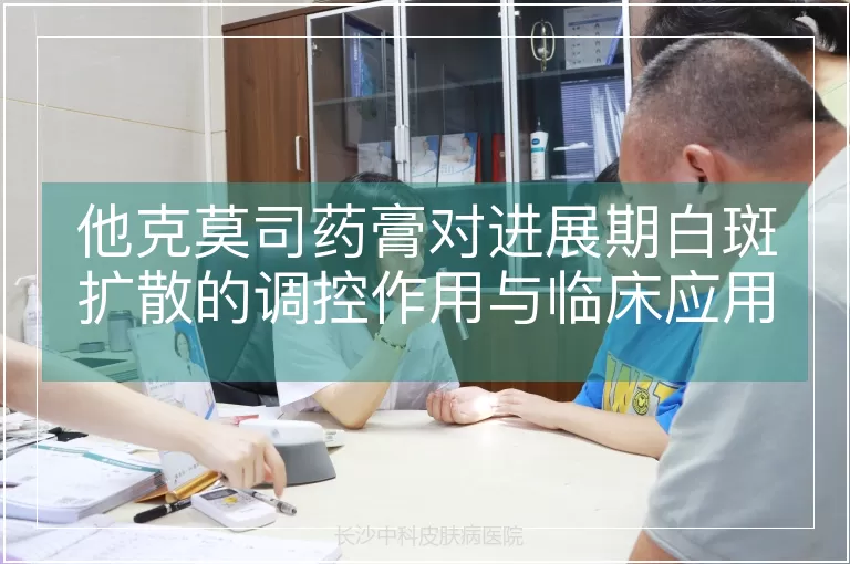 他克莫司药膏对进展期白斑扩散的调控作用与临床应用分析