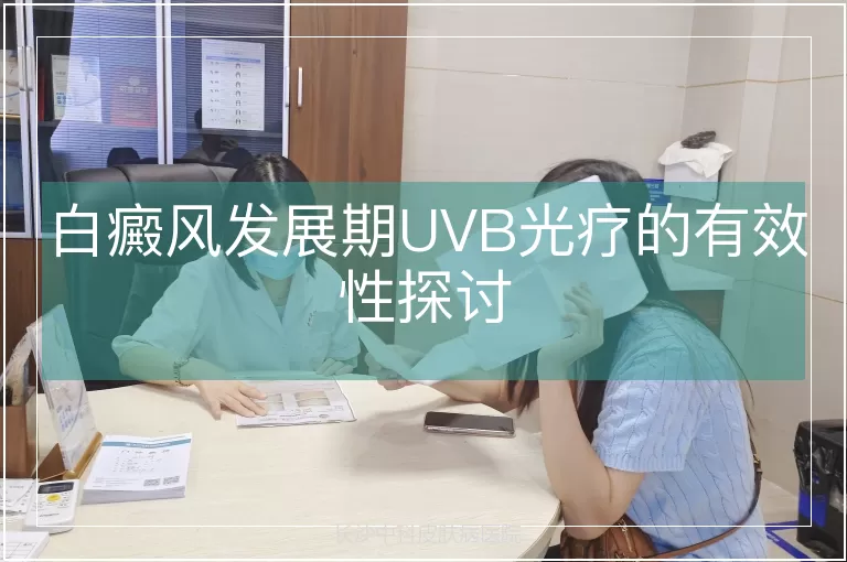 白癜风发展期UVB光疗的有效性探讨