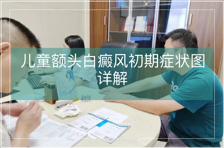 儿童额头白癜风初期症状图详解
