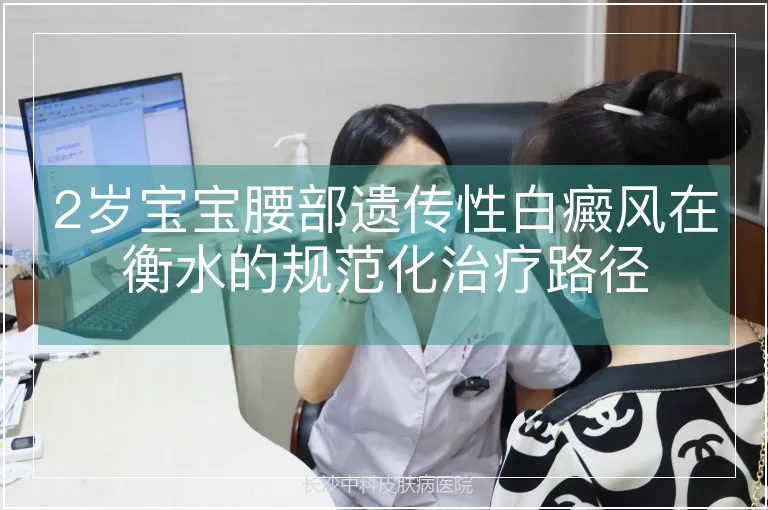 2岁宝宝腰部遗传性白癜风在衡水的规范化治疗路径