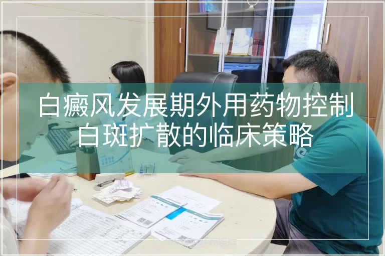 白癜风发展期外用药物控制白斑扩散的临床策略