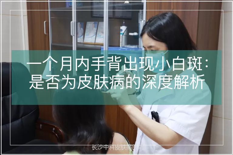一个月内手背出现小白斑:是否为皮肤病的深度解析
