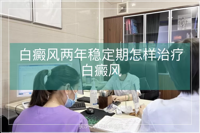 白癜风两年稳定期怎样治疗白癜风