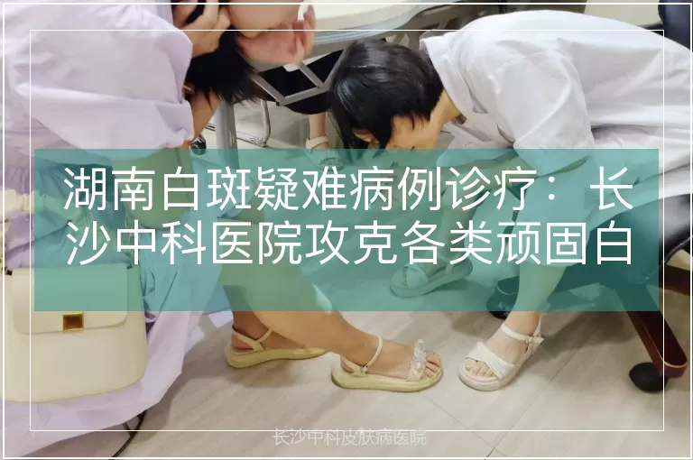 湖南白斑疑难病例诊疗：长沙中科医院攻克各类顽固白斑
