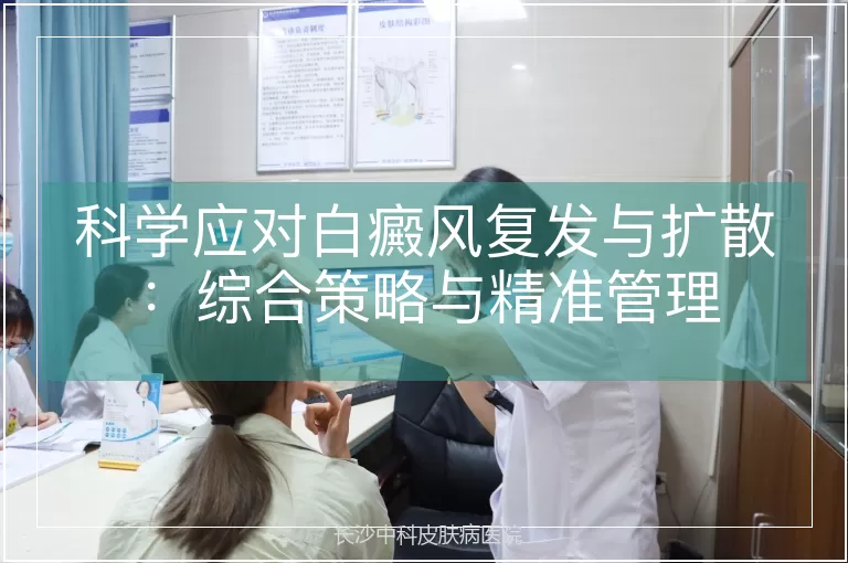 科学应对白癜风复发与扩散：综合策略与精准管理