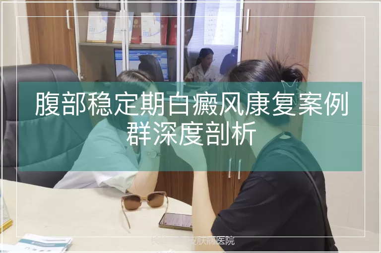 腹部稳定期白癜风康复案例群深度剖析