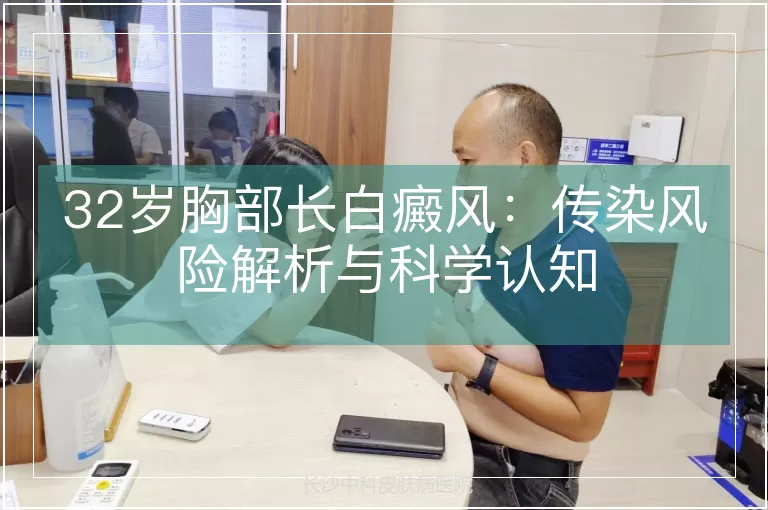 32岁胸部长白癜风:传染风险解析与科学认知