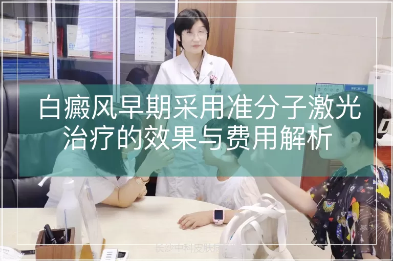 白癜风早期采用准分子激光治疗的效果与费用解析